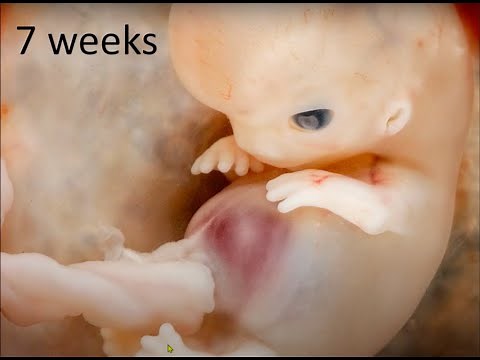 Fetal development