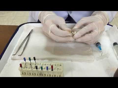 Stepback Technique (Endo)