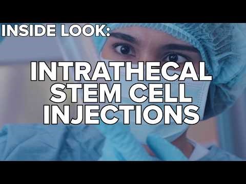 How Intrathecal Stem Cell Injections Are Done