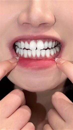 Japanese Teeth Whitening Products: How to Brighten Your Smile