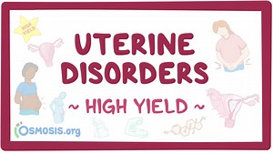 Uterine disorders: Pathology review: Video, Causes, & Meaning | Osmosis