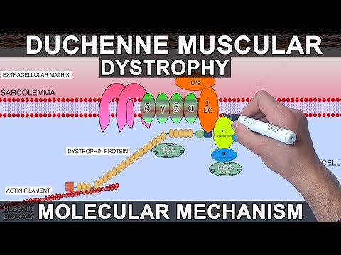 Duchenne Muscular Dystrophy