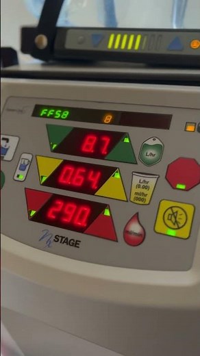 NxStage Home Dialysis Machine - Pressures Hack (Arterial & Venus)