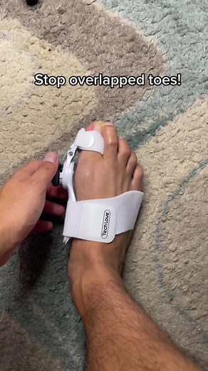Say Goodbye to Overlapping Toes with This Simple Solution!