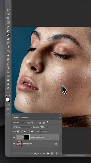 Easy and Quick Way to Retouch Skin in Photoshop #commercialphotoediting #photoshopskinretouching