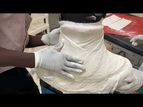 Cervical Spine Immobilization with Neck Collar Padding and Plaster Casting for LMIC Settings