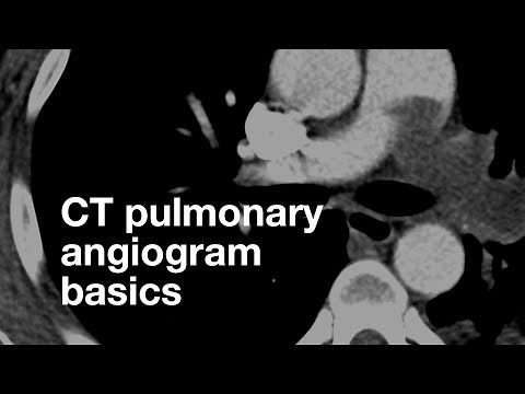 Pulmonary CT Angiogram Basics