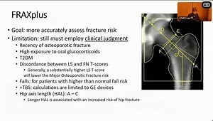 Bone Densitometry: Review of the Basics, T-Scores, and Capturing Bone Quality