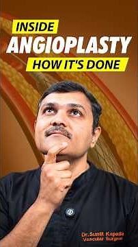 Top VASCULAR Specialist Reveals ANGIOPLASTY Techniques