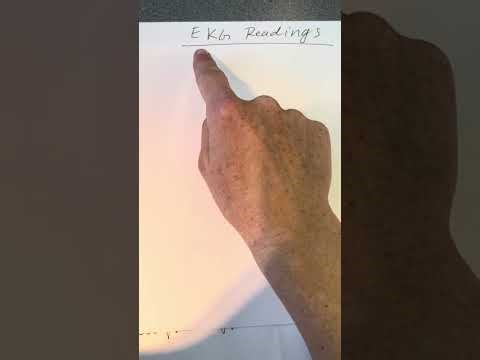 EKG: normal versus abnormal rhythms