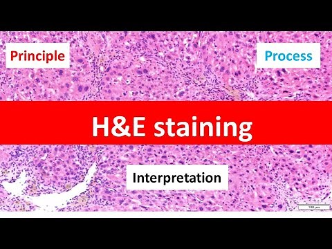 HE Staining: Principle, Procedure, and Interpretation | Haematoxylin and Eosin Staining |