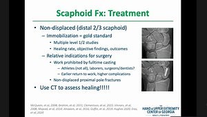 The Scaphoid Fracture Update: What Are the Diagnostic Criteria? What Technique Gives Better Results: Percutaneous Fixation, Volar Plating or Screw Fixation?