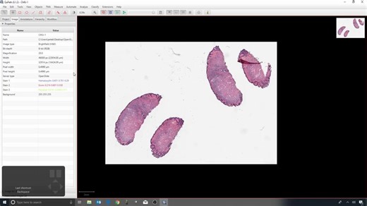 病理学切片开源处理软件QuPath官方教程 12 - QuPath and ImageJ