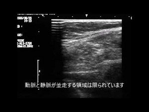 下肢静脈エコートレーニングについて、ShuzouArakaki周超音波研究所
