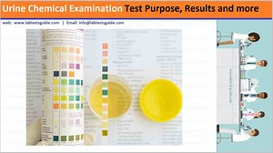 Urine Glucose Test: Purpose, Procedure, Results, and Interpretation