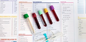 What do your blood test results mean? A toxicologist explains the basics of how to interpret them