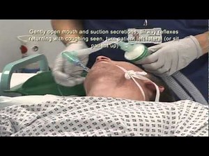 Intubation Extubation 6/7