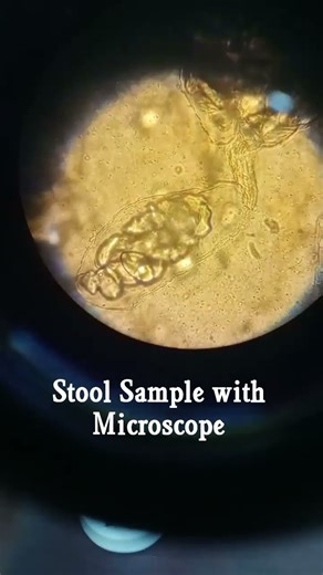 What is a identify this stool sample # Stool Test# Stool under microscope