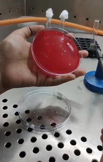 How To Streak For Blood Agar Plates (Bacterial Streaking Technique)