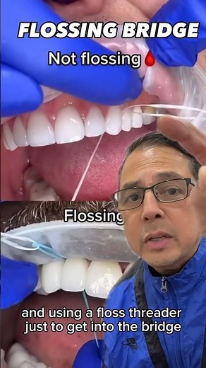 How to Properly Floss Your Dental Bridge | In Office to Hands On Dental Training #shorts