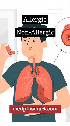 Types of Asthma | MedPlus