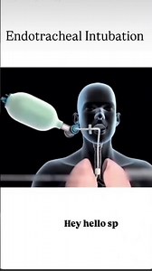 Endotracheal Intubation #mbbs #nursing #mbbs #college #bscnursing #subscribe #khansir #music