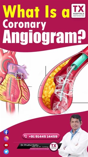 What Is a Coronary Angiogram? | Explained by Dr. Pruthvi Gattu || TX Hospitals