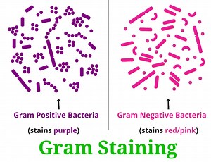 Gram Staining Procedure : Principle, Practical, and Example - RBR Life Science