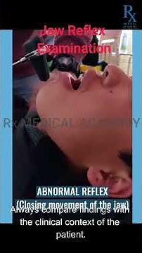 Jaw Reflex Examination | Cranial Nerve Clinical Test Tutorial