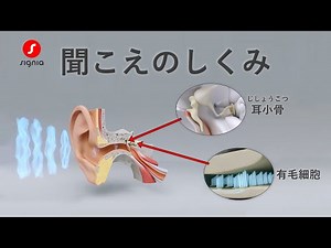 シグニア補聴器 | 聞こえの仕組み