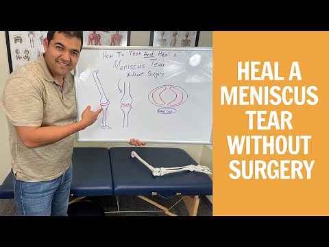 How To Test & Heal A Meniscus Tear Without Surgery