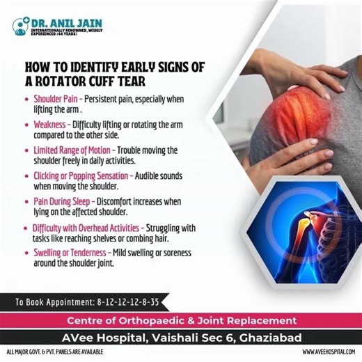 How to Identify Early Signs of a Rotator Cuff Tear