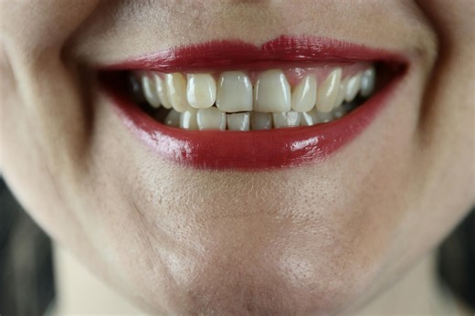 The world’s first tooth-regrowing drug has been approved for human trials