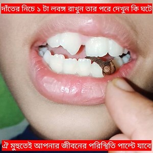 1.9M views · 11K reactions | দাঁ*তের নিচে এক টু"করো লবঙ্গ রাখুন তার পরে দেখুন কি ঘ''টে আপনি চ"মকে উঠবেন অ'বাক হয়ে যাবে আপনার জীবন বদলে যাবে পৃ''থিবীর কেউ চা"য়না আপনি এটা জানেন যেই দেখবে সেই অ'বাক হবে | Tithe's Vlog & Cooking | Facebook