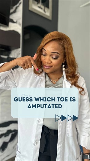 42 reactions · 4 comments | Which Toe Was Amputated? 禮 Diabetes can...