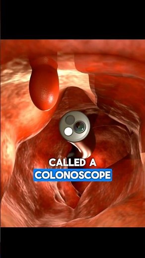 Colonoscopy | Dr. Paulien Moyaert