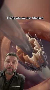 Heart Surgeon Reviews Titanium Cutting Board | Is It the Healthiest Option for Your Kitchen?