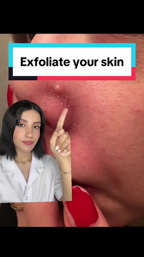 Effective Ways to Treat Large Pores and Blackheads