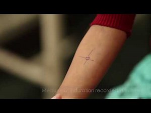 PPD Skin Test Form ≡ Fill Out Printable PDF Forms Online