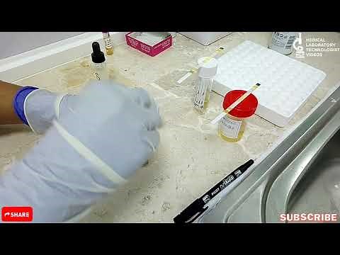 Fecal occult blood test.Practical explanation. How to perform FOB test in Lab?Easy explain (English)