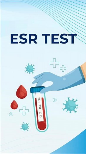 Erythrocyte Sedimentation Rate | ESR Test