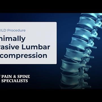 Minimally Invasive Lumbar Decompression | MILD Procedure