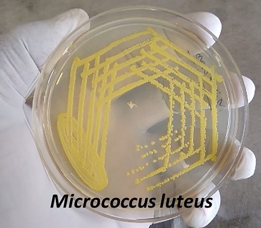 Micrococcus: Introduction, Classification, Morphology, Pathogenecity, Lab