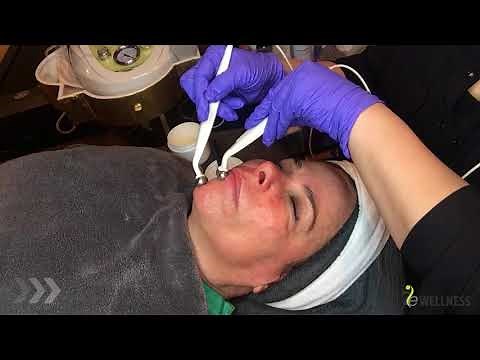 Transform Your Skincare: Microcurrent and Nano Infusion Facial Protocol for Youthful Skin