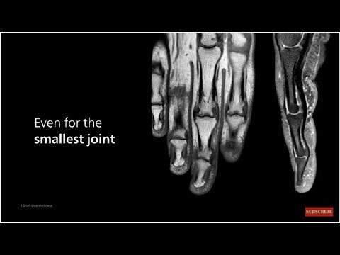 Unleash the power of the Philips MR 5300 - discover the benefits