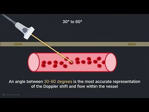 Ultrasound Physics Explained - How does Ultrasound Doppler Imaging work?