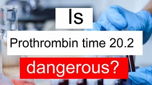 Is Prothrombin time 20.2 high, normal or dangerous? What does PT level 20.2 mean?