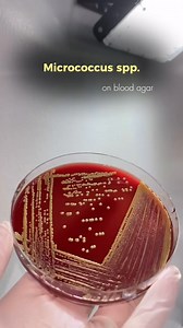 Micrococcus spp on blood agar | Microbiologist BD