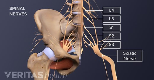 What You Need to Know About Sciatica