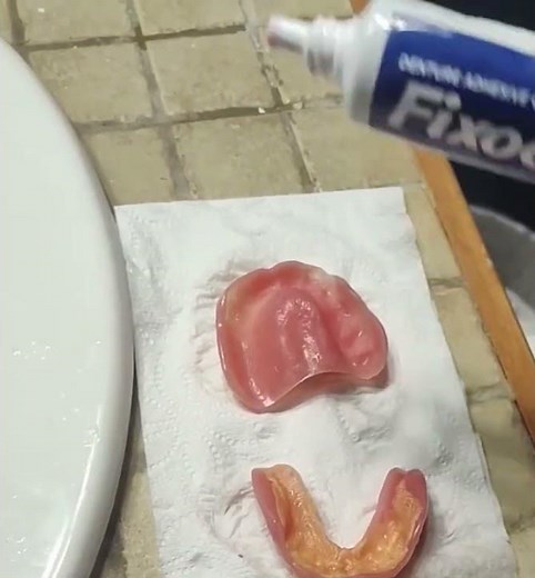 How To Apply Denture Adhesive For The First Time